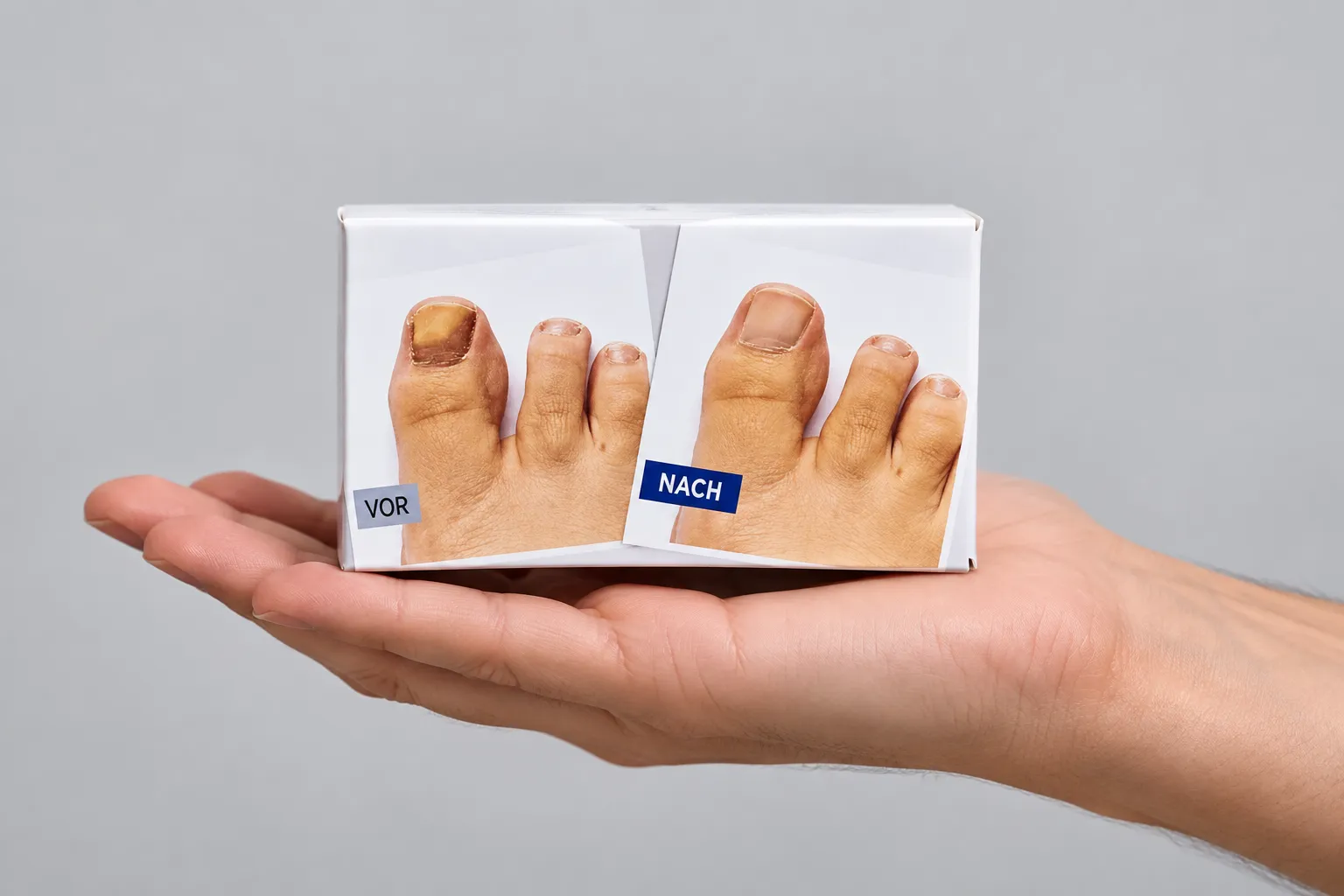 EXODERMIN EU — Verpackung in der Hand